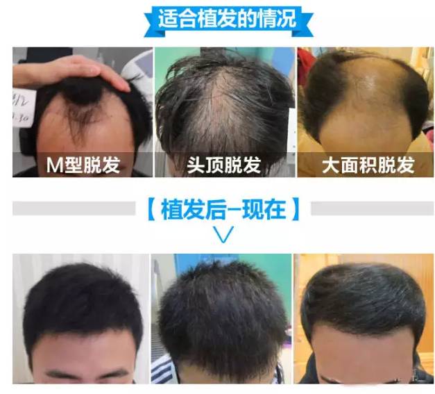 运输服务 第100页